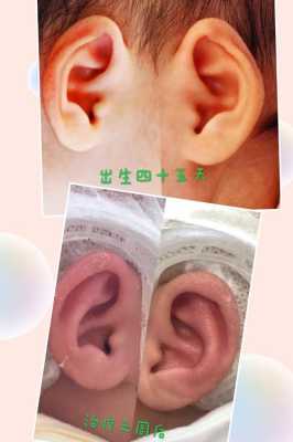 胎儿耳廓(胎儿耳廓形态异常难道就是畸形吗) 第3张 胎儿耳廓(胎儿耳廓形态异常难道就是畸形吗) 第3张