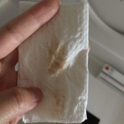 孕期见红是褐色的东西(孕期流褐色血严重吗) 第1张 孕期见红是褐色的东西(孕期流褐色血严重吗) 第1张
