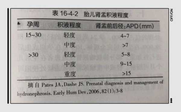 胎儿肾积水正常范围(小孩生下来肾吸水11MM会好吗) 第2张 胎儿肾积水正常范围(小孩生下来肾吸水11MM会好吗) 第2张