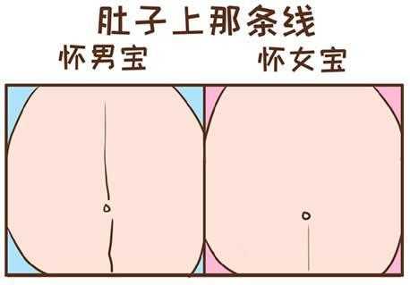 怀孕肠梗阻怎么办,孕期肚子线不直是男孩女孩 第2张 怀孕肠梗阻怎么办,孕期肚子线不直是男孩女孩 第2张