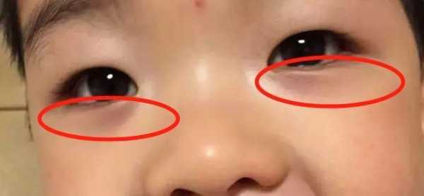 九个月宝宝眼袋看起来好重,九个月胎儿图片 第2张 九个月宝宝眼袋看起来好重,九个月胎儿图片 第2张