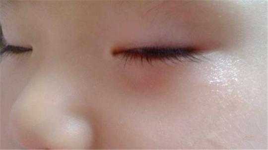 九个月宝宝眼袋看起来好重,九个月胎儿图片 第1张 九个月宝宝眼袋看起来好重,九个月胎儿图片 第1张