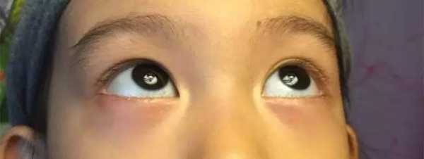 九个月宝宝眼袋看起来好重,九个月胎儿图片 第3张 九个月宝宝眼袋看起来好重,九个月胎儿图片 第3张