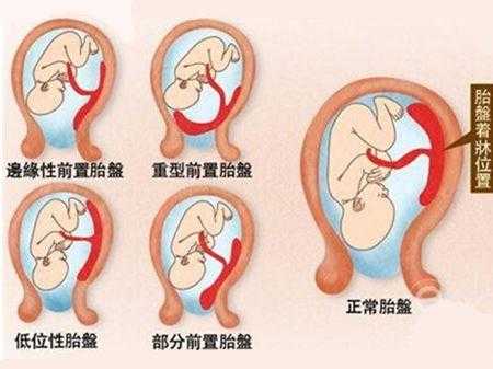 胎儿什么时候长胎盘(多久周开始长胎盘) 第2张 胎儿什么时候长胎盘(多久周开始长胎盘) 第2张