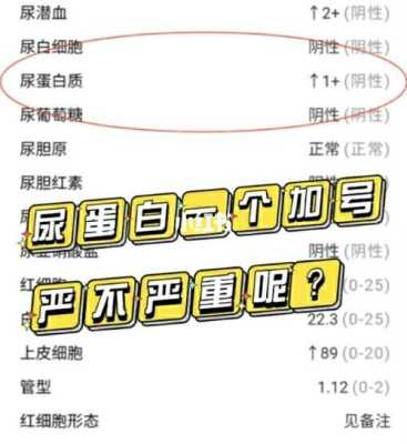 孕期尿蛋白1个加号(孕期尿蛋白1个加号正常吗) 第2张 孕期尿蛋白1个加号(孕期尿蛋白1个加号正常吗) 第2张