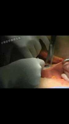 8斤的胎儿(8斤的胎儿顺产还是剖腹产) 第2张 8斤的胎儿(8斤的胎儿顺产还是剖腹产) 第2张