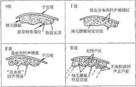 生孩子的时候胎盘一般达到几级,胎儿几周长胎盘开始分泌孕激素 第2张 生孩子的时候胎盘一般达到几级,胎儿几周长胎盘开始分泌孕激素 第2张