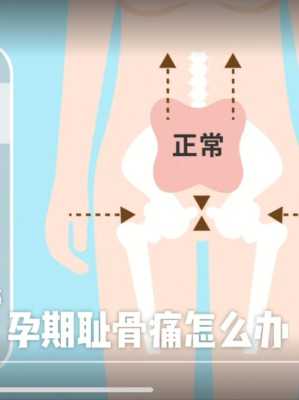 孕妇耻骨疼怎么回事,孕期趾骨痛在哪个部位 第1张 孕妇耻骨疼怎么回事,孕期趾骨痛在哪个部位 第1张