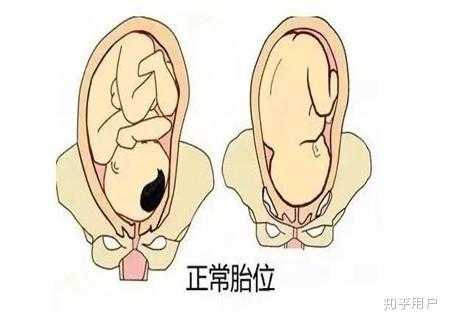 孕30周,胎儿头位低是什么意思呢,有什么影响,胎儿头太低有什么影响 第2张 孕30周,胎儿头位低是什么意思呢,有什么影响,胎儿头太低有什么影响 第2张