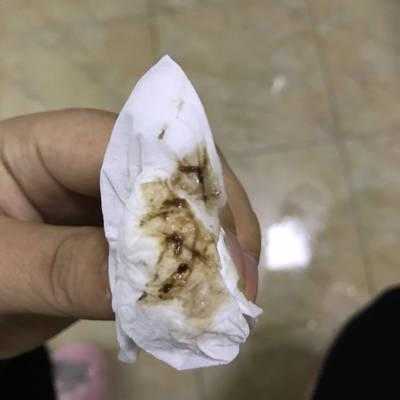 怀孕6周出现褐色血该怎么办,孕期出褐色血要紧吗 第2张 怀孕6周出现褐色血该怎么办,孕期出褐色血要紧吗 第2张