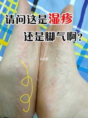 怀孕期间脚气(怀孕了脚气很痒怎么办,怀孕了脚气发作怎么办) 第2张 怀孕期间脚气(怀孕了脚气很痒怎么办,怀孕了脚气发作怎么办) 第2张