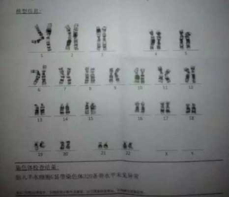 从b超单看胎儿性别（从b超单看胎儿性别准吗）  第2张