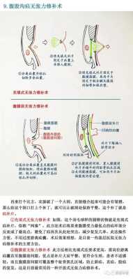 小孩疝气怎么治,胎儿肠疝是什么意思 第2张 小孩疝气怎么治,胎儿肠疝是什么意思 第2张