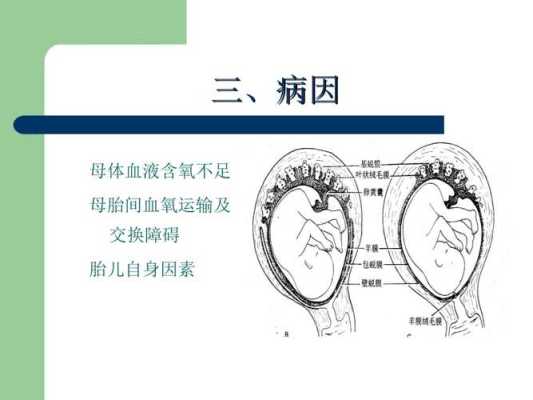 胎儿腔内(胎儿腔内窘迫) 第1张 胎儿腔内(胎儿腔内窘迫) 第1张