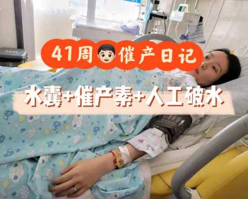 41周胎儿(41周胎儿不发动是刨腹好点还是催产) 第1张 41周胎儿(41周胎儿不发动是刨腹好点还是催产) 第1张