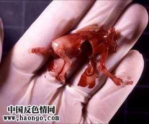 胎儿流产有哪些症状(胎儿流产有哪些症状和反应) 第1张 胎儿流产有哪些症状(胎儿流产有哪些症状和反应) 第1张