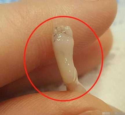胎儿流产有哪些症状(胎儿流产有哪些症状和反应) 第2张 胎儿流产有哪些症状(胎儿流产有哪些症状和反应) 第2张