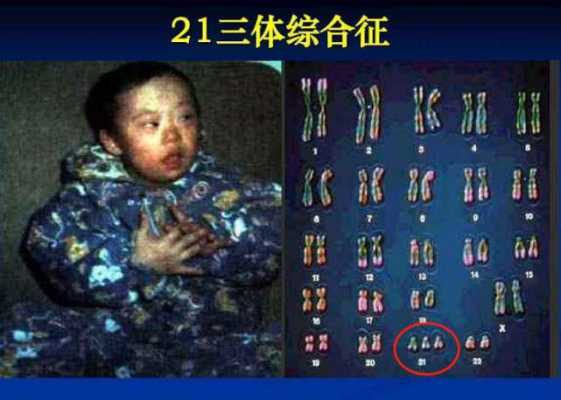 孕期特征(怀了唐氏儿的孕妇特征有哪些呢) 第3张 孕期特征(怀了唐氏儿的孕妇特征有哪些呢) 第3张