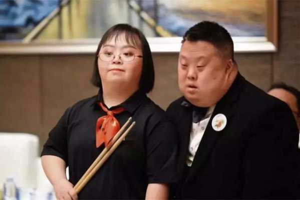 孕期特征(怀了唐氏儿的孕妇特征有哪些呢) 第2张 孕期特征(怀了唐氏儿的孕妇特征有哪些呢) 第2张