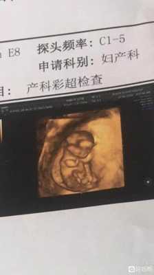 12周胎儿成型了吗（12周胎儿成型了吗）  第1张