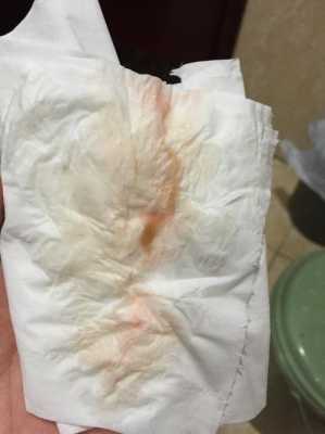 孕期流血会影响胎儿吗(怀孕13周,突然见红是怎么回事,宝宝会不会有危险,挺着急的) 第1张 孕期流血会影响胎儿吗(怀孕13周,突然见红是怎么回事,宝宝会不会有危险,挺着急的) 第1张