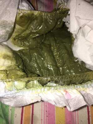 二个月胎儿(2个月宝宝放屁有大便) 第2张 二个月胎儿(2个月宝宝放屁有大便) 第2张