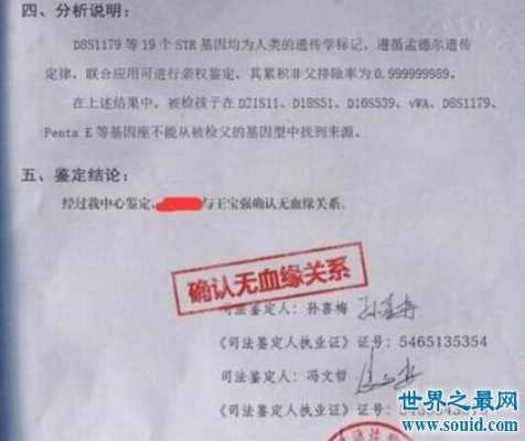 做胎儿亲子鉴定(怀孕多久可以做DNA鉴定呢,对胎儿会有危害吗) 第2张 做胎儿亲子鉴定(怀孕多久可以做DNA鉴定呢,对胎儿会有危害吗) 第2张