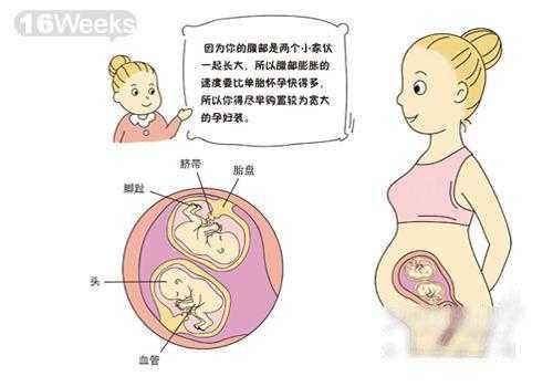 双胞胎胎儿图(双胞胎胎儿之间有隔膜) 第3张 双胞胎胎儿图(双胞胎胎儿之间有隔膜) 第3张