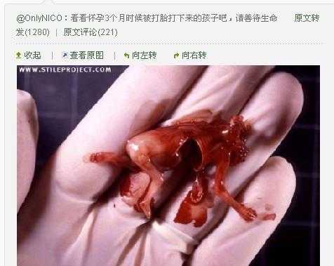 五个月引产都需要什么,5个月胎儿引产后多久可以再孕  第3张