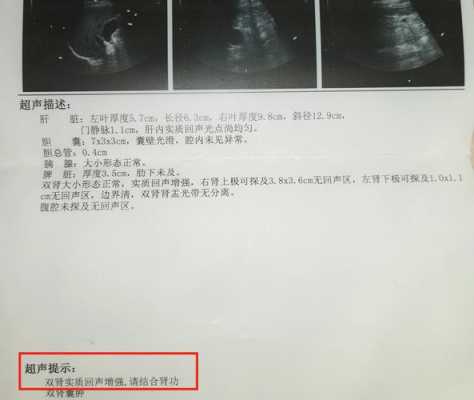 双肾皮质回声增强怎么回事,胎儿双肾皮质回声增强是怎么回事 第1张 双肾皮质回声增强怎么回事,胎儿双肾皮质回声增强是怎么回事 第1张