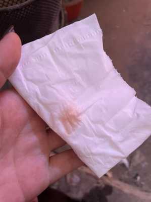 孕期白带白色(怀孕有淡粉色白带怎么回事) 第3张 孕期白带白色(怀孕有淡粉色白带怎么回事) 第3张