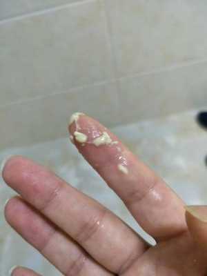 流产后胎儿的DNA在母体内会留存多久,胎儿的排泄物母体怎么排出去 第2张 流产后胎儿的DNA在母体内会留存多久,胎儿的排泄物母体怎么排出去 第2张