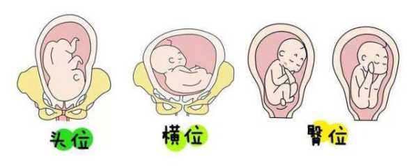 孕25周胎头朝下,正常吗?以后还会转过来的吗,一般胎儿几周头朝下 第3张 孕25周胎头朝下,正常吗?以后还会转过来的吗,一般胎儿几周头朝下 第3张