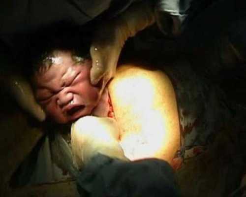 生孩子的真实过程,女人生孩子有多痛苦,胎儿在子宫里的视频真实 第1张 生孩子的真实过程,女人生孩子有多痛苦,胎儿在子宫里的视频真实 第1张