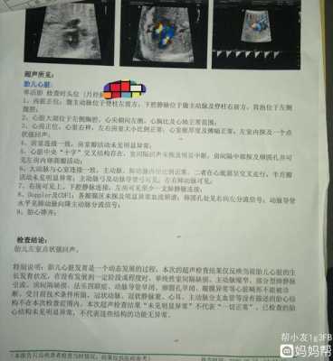 胎儿左心室灶性强回声(做四维彩超见左心室有一点强回声,怎么回事) 第1张 胎儿左心室灶性强回声(做四维彩超见左心室有一点强回声,怎么回事) 第1张