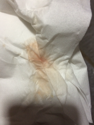 孕期白带红 第3张 孕期白带红 第3张
