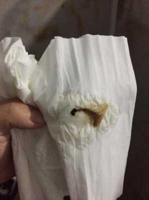 孕期白带红 第2张 孕期白带红 第2张