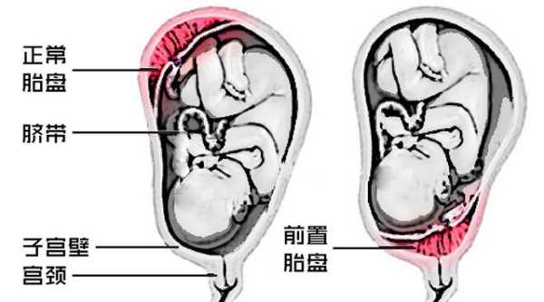 胎儿胎盘图(胎盘的结构是什么) 第1张 胎儿胎盘图(胎盘的结构是什么) 第1张