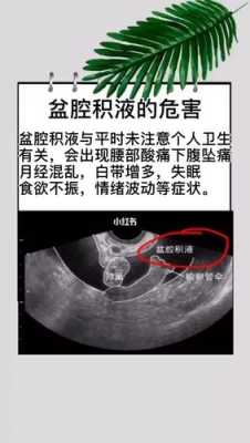 盆腔积液的危害有哪些呢,怀孕检查盆腔积液对胎儿有影响吗 第1张 盆腔积液的危害有哪些呢,怀孕检查盆腔积液对胎儿有影响吗 第1张