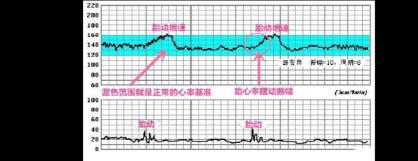 孕38周胎心164好不好?怎么通过胎心来判断宝宝的发育情况,胎儿38周发育标准尺寸 第1张 孕38周胎心164好不好?怎么通过胎心来判断宝宝的发育情况,胎儿38周发育标准尺寸 第1张