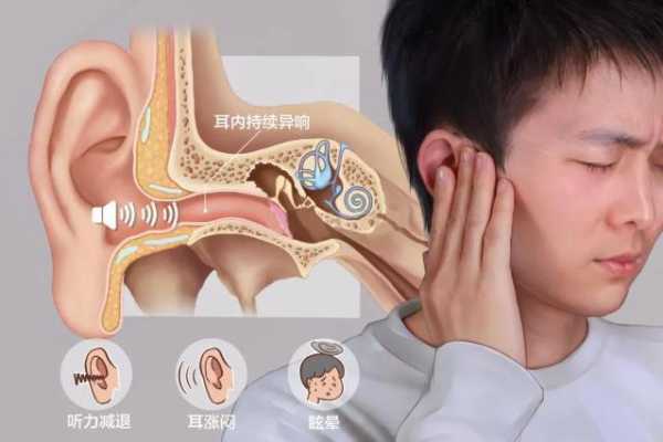 孕期耳朵嗡嗡响怎么办(孕期耳朵嗡嗡响怎么办) 第2张 孕期耳朵嗡嗡响怎么办(孕期耳朵嗡嗡响怎么办) 第2张