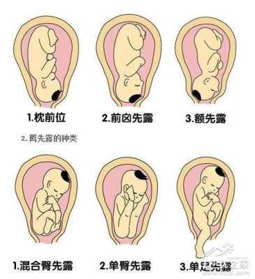胎儿枕位图(六个月宝宝枕部是哪里) 第2张 胎儿枕位图(六个月宝宝枕部是哪里) 第2张