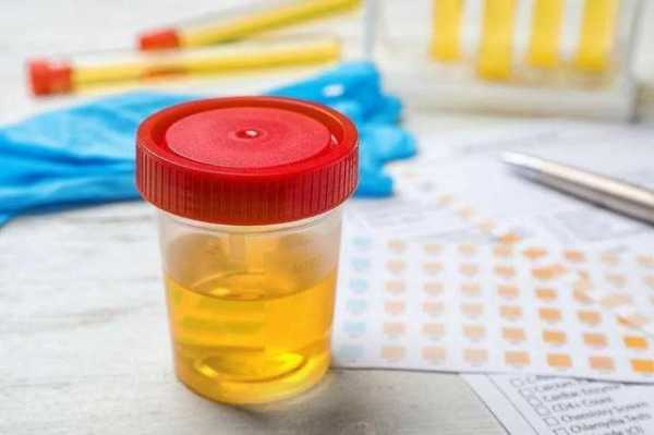 孕期尿酸碱(厕所污水偏酸还是碱性) 第2张 孕期尿酸碱(厕所污水偏酸还是碱性) 第2张