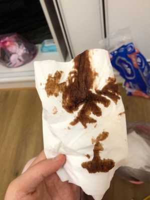 孕期就黑血（孕期黑血是好转吗）  第2张