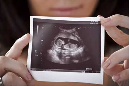 三个月胎儿四维彩超(怀孕几个月做四维彩超最好) 第3张 三个月胎儿四维彩超(怀孕几个月做四维彩超最好) 第3张