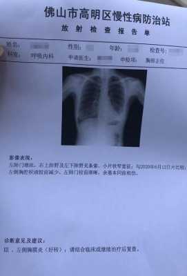 胎儿肺积水（胎儿肺积水是怎么引起的）  第1张
