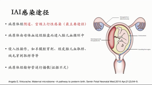 胎儿宫内感染的原因(胎儿宫内感染的原因) 第1张 胎儿宫内感染的原因(胎儿宫内感染的原因) 第1张