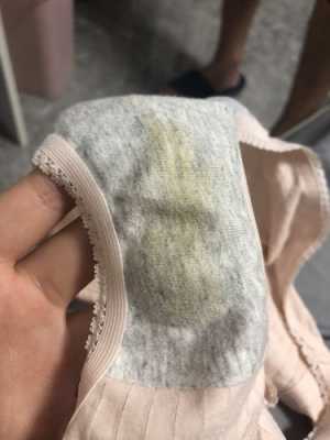 孕妇有白带属于是正常的吗, 第3张 孕妇有白带属于是正常的吗, 第3张