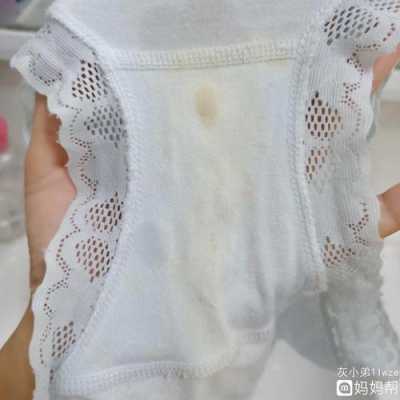 孕妇有白带属于是正常的吗, 第2张 孕妇有白带属于是正常的吗, 第2张