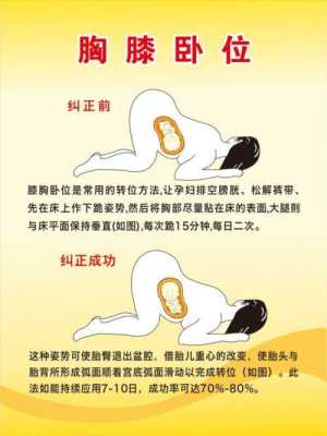 胎儿胎位不正(如何纠正孕妇胎位) 第1张 胎儿胎位不正(如何纠正孕妇胎位) 第1张